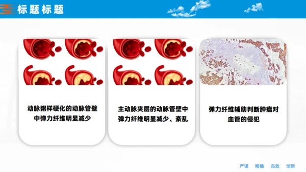 非小细胞肺癌的胸膜侵犯医学课件通用PPT模板