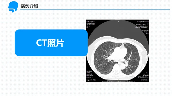 呼吸科护理查房PPT课件（呼吸衰竭）