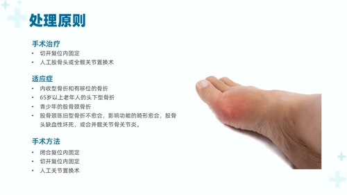 绿色实拍医疗护理培训股骨骨折护理查房培训PPT课件