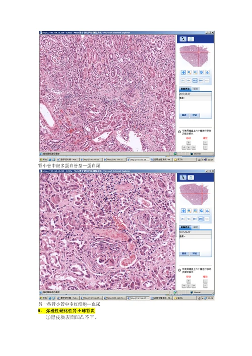 病理学各论切片：泌尿生殖系统