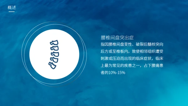 腰椎间盘突出护理查房通用PPT模板