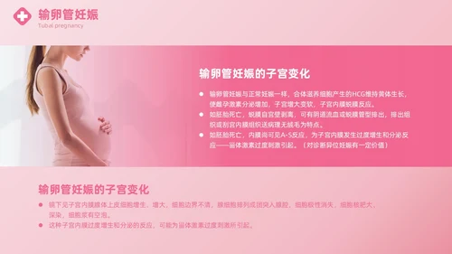 粉色实拍风异位妊娠的诊治医疗健康母婴孕妇培训PPT