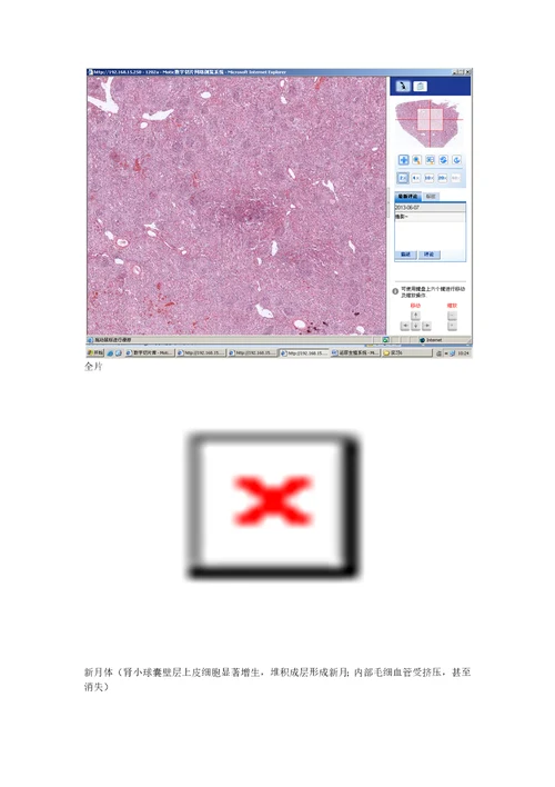 病理学各论切片：泌尿生殖系统