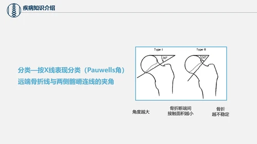 股骨颈骨折术后护理查房培训教学PPT课件