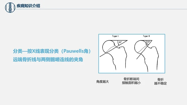 股骨颈骨折术后护理查房培训教学PPT课件