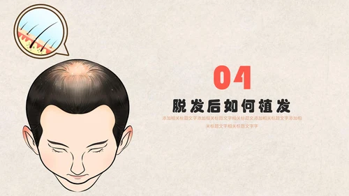 医疗健康预防脱发教学讲座通用PPT课件