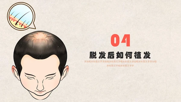 医疗健康预防脱发教学讲座通用PPT课件