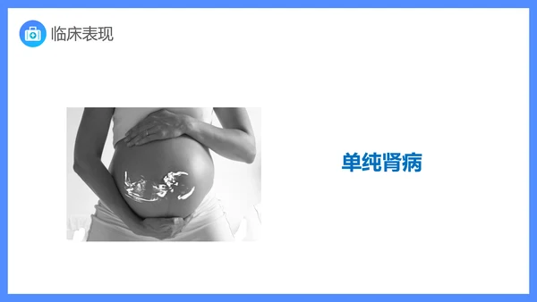 原发性肾病综合症医疗护理查房PPT课件模板