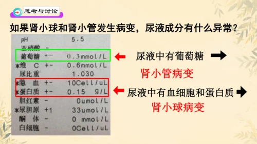 初中生物学人教版（新课程标准）七年级下册4.5 人体内废物的排出课件(共24张PPT)