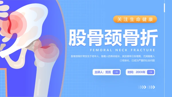 蓝色插画风股骨颈骨医护人员培训讲座医学护理PPT