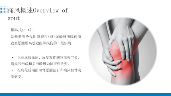 蓝色简约商务痛风患者患者护理医疗培训PPT课件