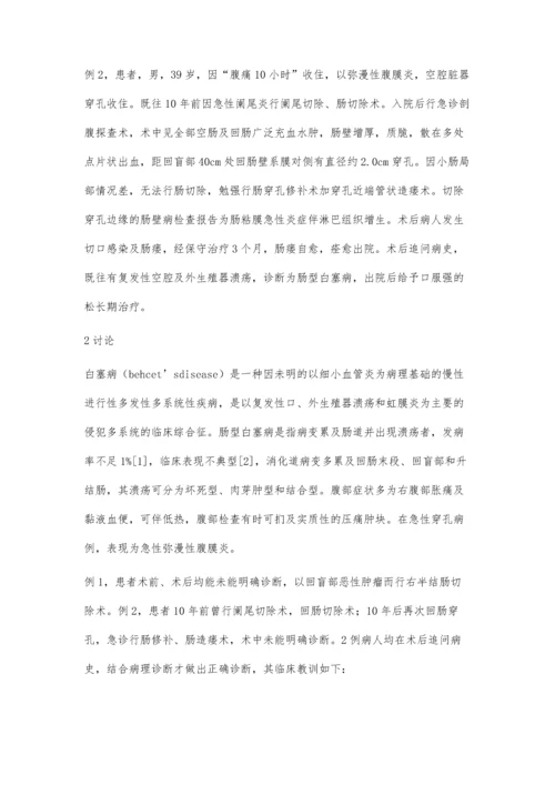 肠型白塞氏病误诊2例报告.docx