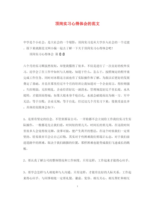 精编顶岗实习心得体会的范文.docx