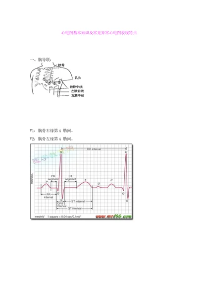 心电图基本知识及常见异常心电图表现