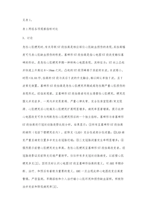 急性心肌梗死ST段呈墓碑形抬高的临床意义.docx