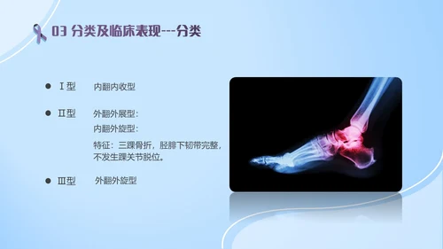 蓝紫色医疗风踝关节骨折护理查房护理PPT模板pptx
