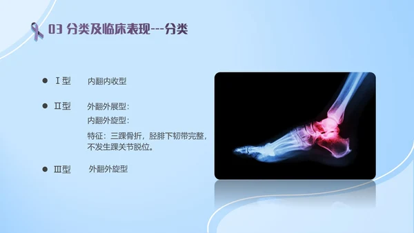 蓝紫色医疗风踝关节骨折护理查房护理PPT模板pptx