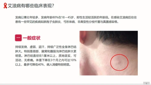 预防艾滋病科普宣讲通用PPT课件