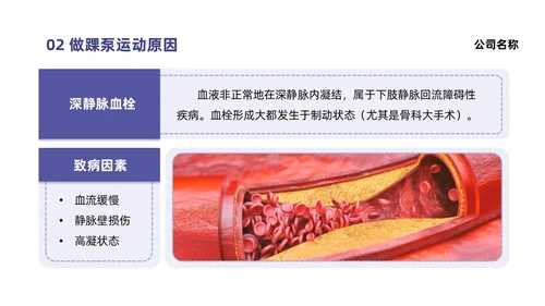 蓝色系紫色系简约风踝泵运动健康宣教培训ppt课件