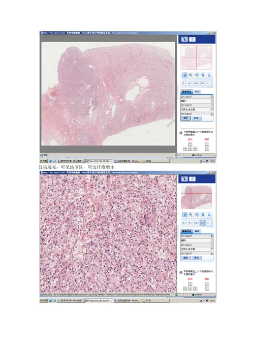 病理学各论切片：泌尿生殖系统