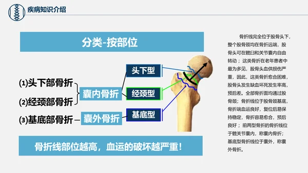 股骨颈骨折术后护理查房培训教学PPT课件