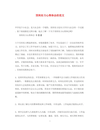 精编顶岗实习心得体会的范文.docx