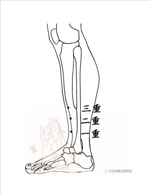 董氏奇穴针灸手部穴位大全建议收藏