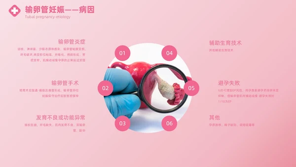 粉色实拍风异位妊娠的诊治医疗健康母婴孕妇培训PPT