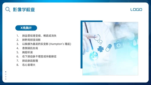 蓝色简约肺栓塞的护理查房PPT模板宣传PPT动态PPT