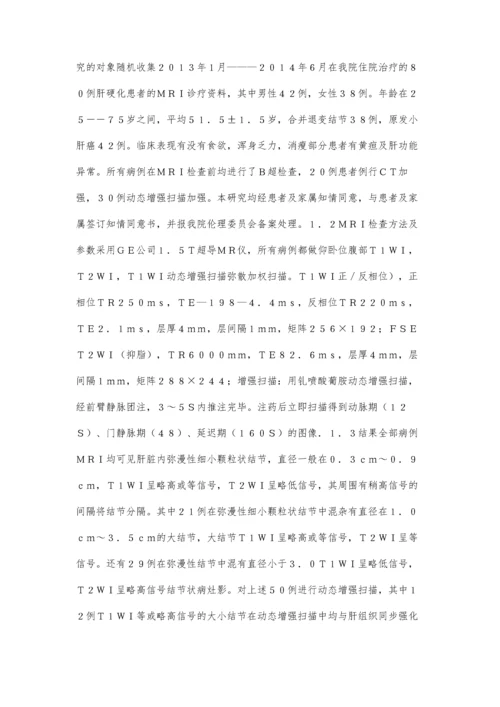 肝硬化结节和小肝癌的MRI研究.docx