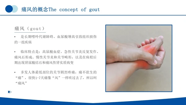 蓝色简约商务痛风健康教育痛风健康宣教PPT课件