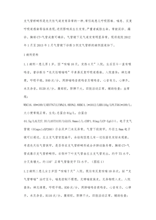 以反复喘息为表现的支气管桥畸形3例病例分析.docx