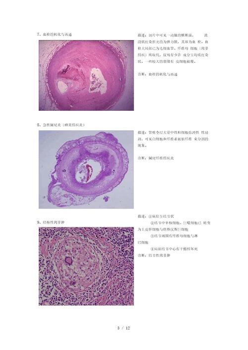 病理切片整理