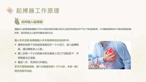 绿色简约风起搏器术后护理培训课件