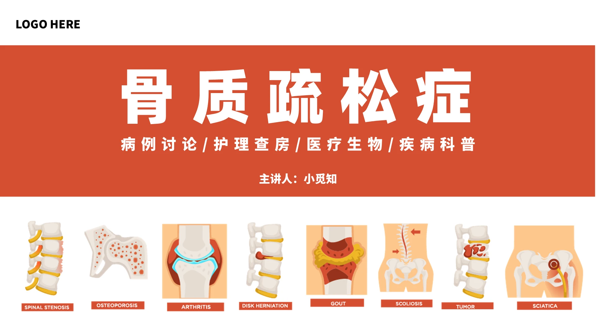 红色简约风骨质疏松症状介绍培训教育课件PPT模板医疗护理