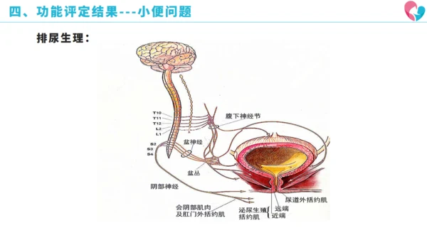 骨盆骨折术后康复历程通用PPT模板