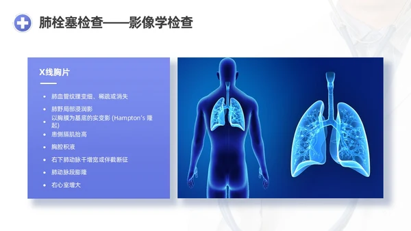 蓝紫渐变商务实拍风肺栓塞护理查房医疗培训PPT模板