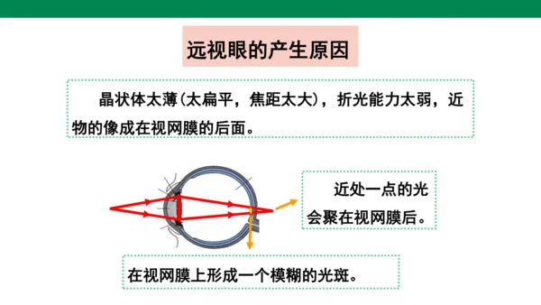 人教版第五章透镜及其应用第4节眼睛和眼镜 课件 (共23张PPT)