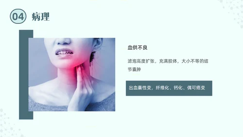 绿色实拍医院培训甲状腺疾病与外科治疗PPT课件