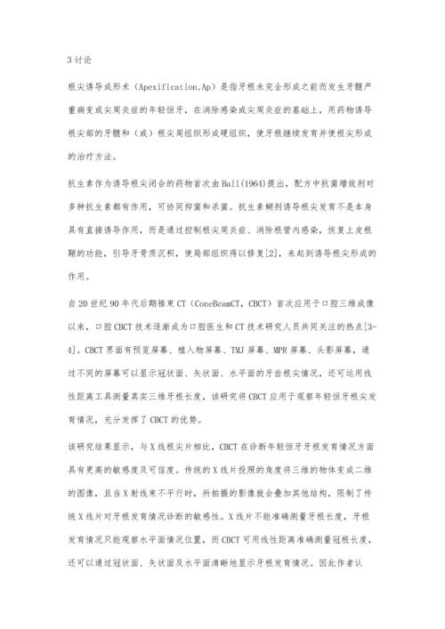 应用CBCT观察年轻恒牙根尖诱导成形术的临床疗效.docx