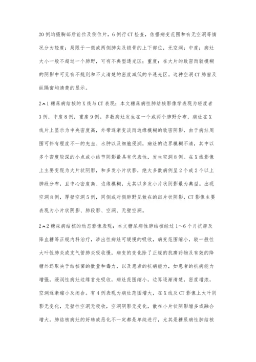 糖尿病合并肺结核20例影像学诊断.docx