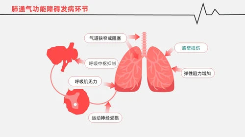 红白色渐变色简约风格呼吸衰竭医护工作人员培训PPT