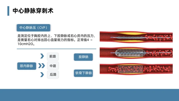 蓝色简约风课件急诊科规范化培训培训课件PPT模板业务培训