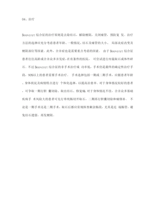 2022胆石症的罕见并发症——Bouveret综合征.docx