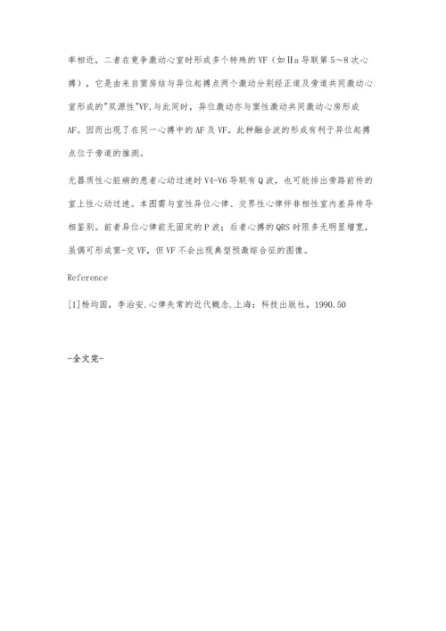 患者心律失常的心电图临床分析诊断.docx