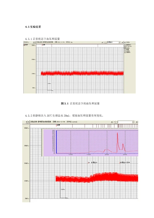 生理实验尿生成的调节