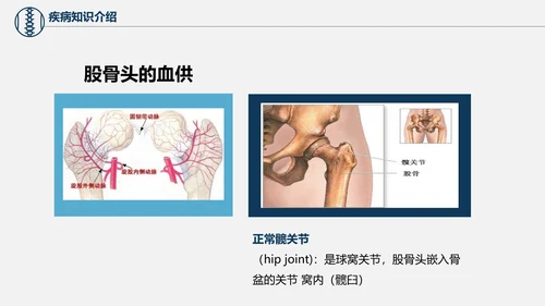 股骨颈骨折术后护理查房培训教学PPT课件