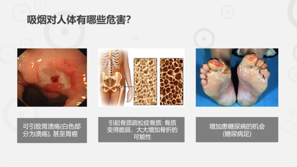 吸烟有害健康世界无烟日主题教育PPT课件
