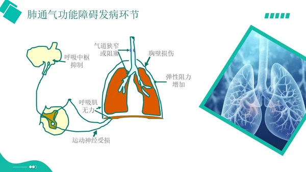 白绿色实拍形状风呼吸衰竭培训PPT