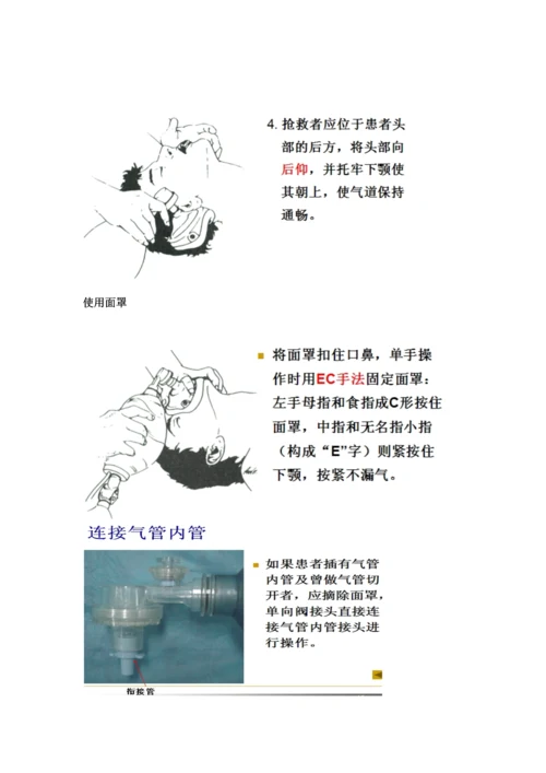 简易呼吸器辅助呼吸操作流程图.docx